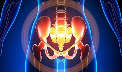 Reasons for varicose veins in the pelvis