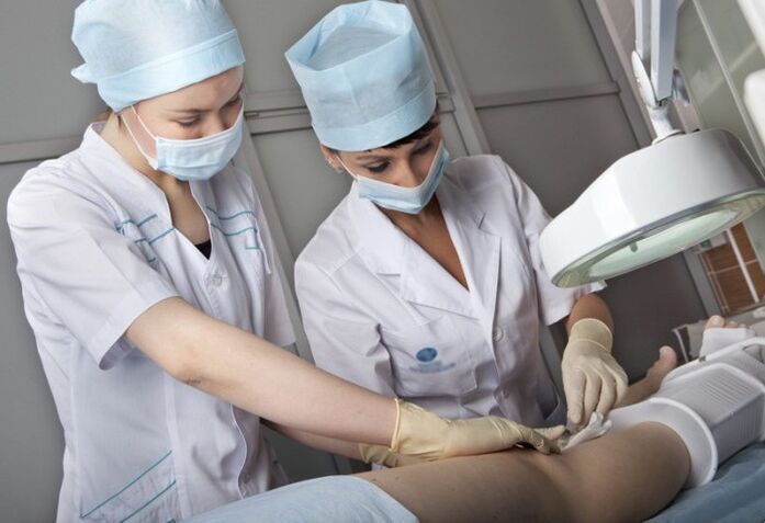 Performing surgical operations on varicose veins in the legs