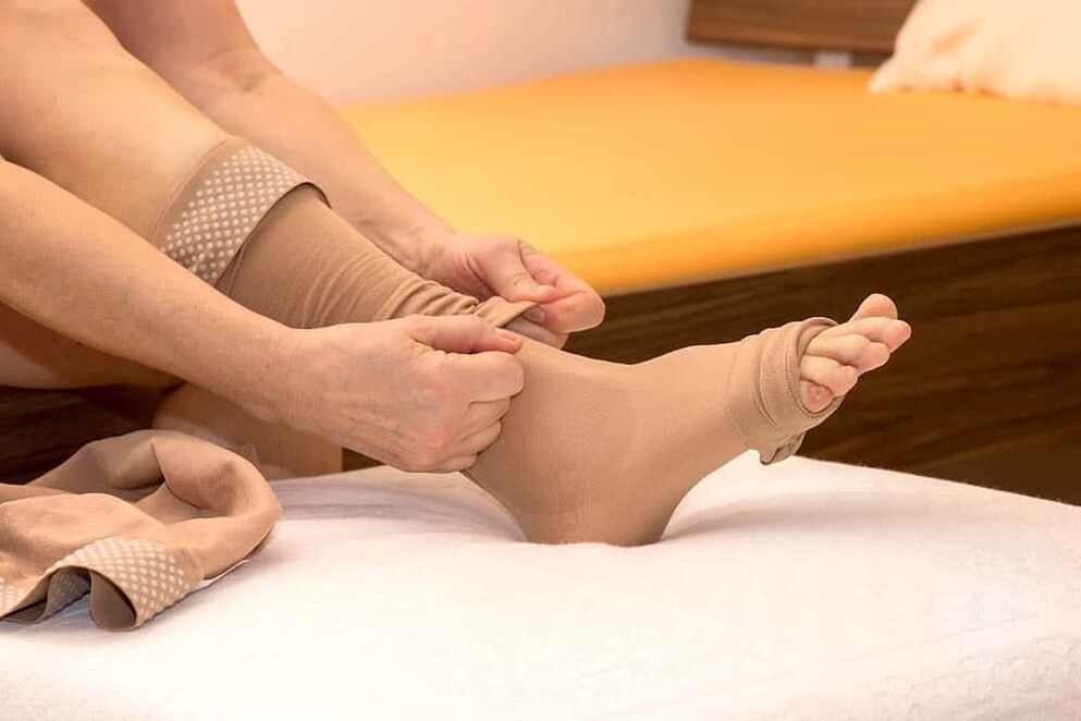 The use of compression stockings will help ease the manifestations of varicose veins. 